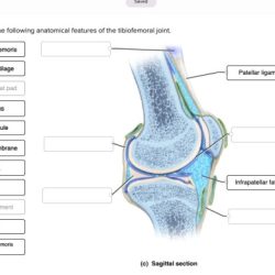 Correctly anatomical tibiofemoral