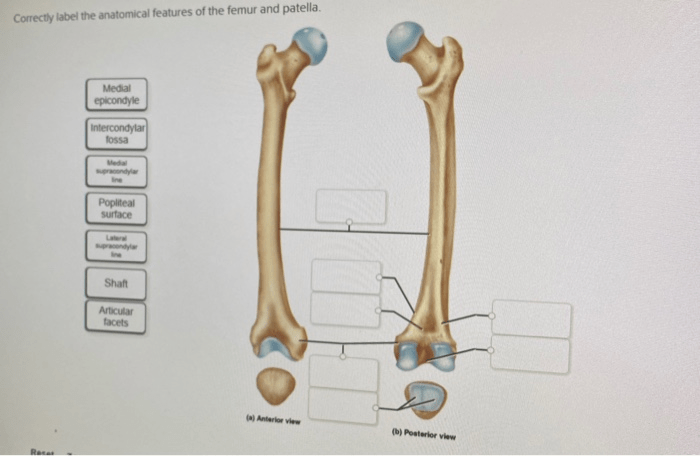 Correctly label the anatomical features of the femur and patella.