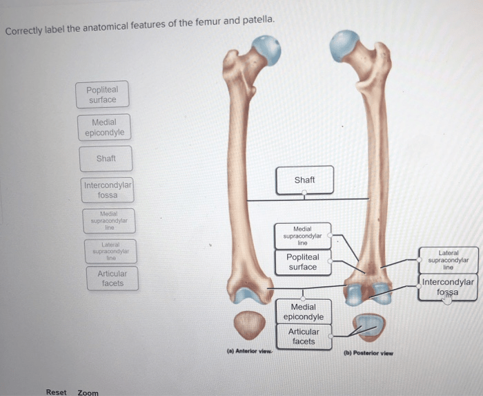 Correctly label the anatomical features of the femur and patella.